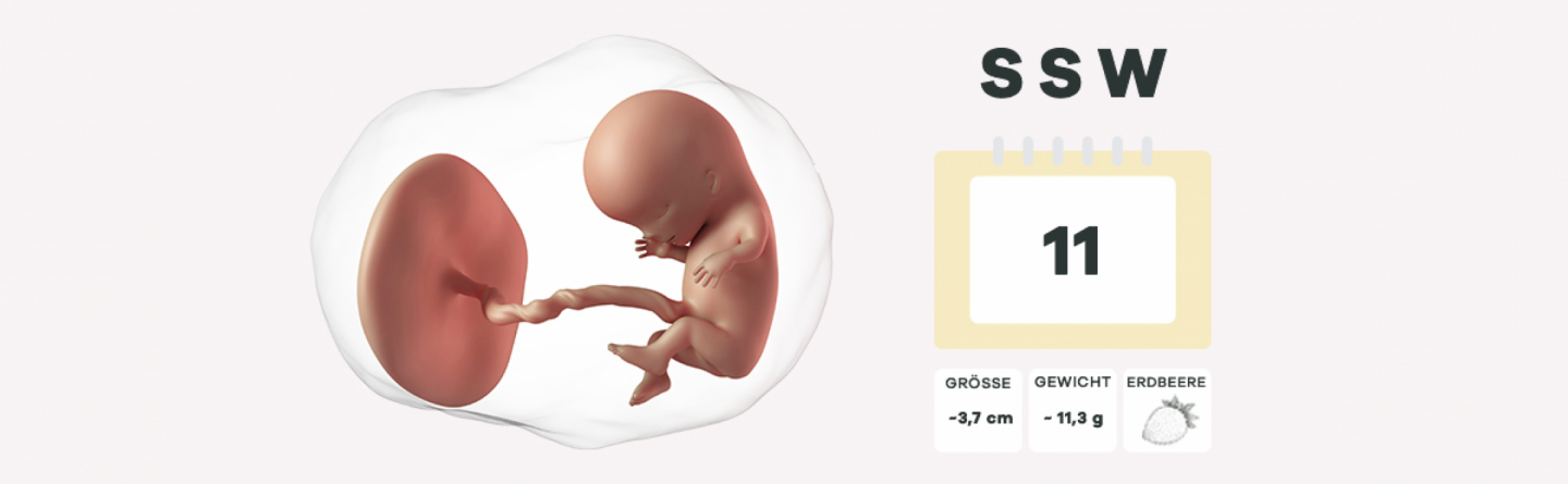 11. Schwangerschaftswoche (SSW)